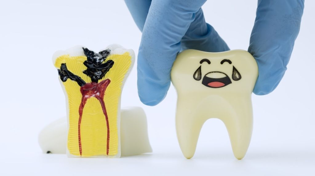 Çocuklarda Diş Çürüğü Neden Hızlı İlerler?